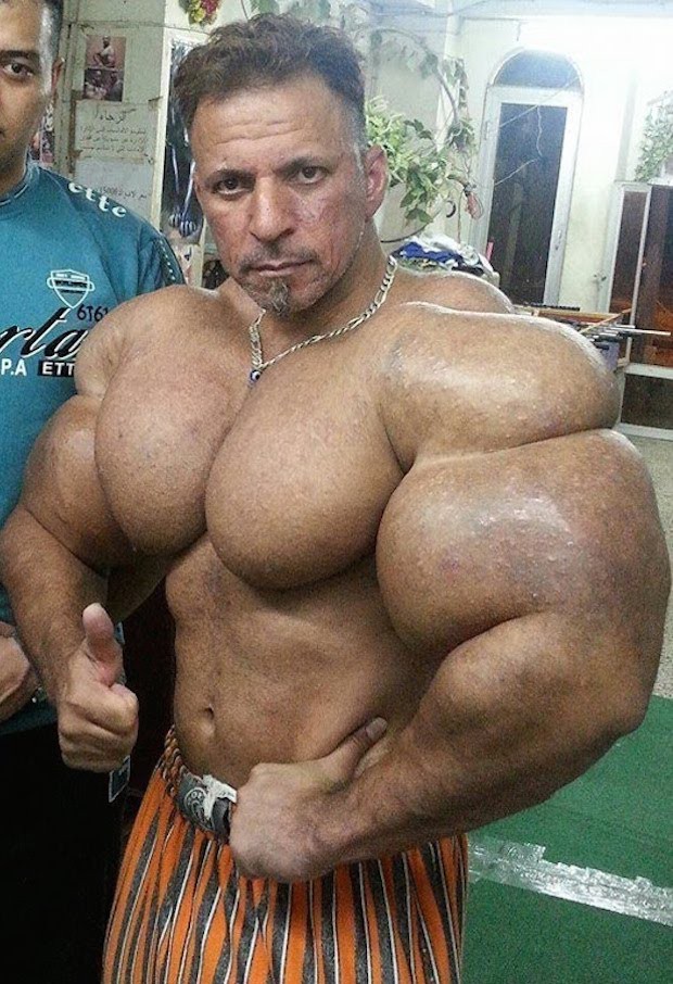 synthol 1