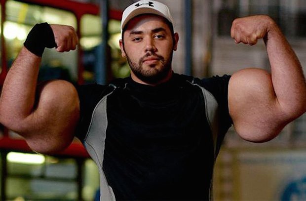 synthol 2